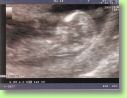 2006.10.04 echo5.jpg